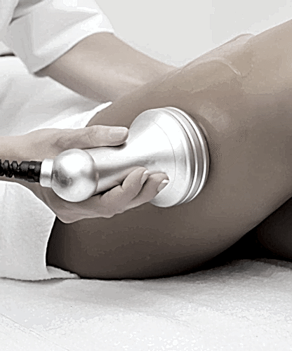 Кавитация. RF-лифтинг Кавитация. RF-лифтинг