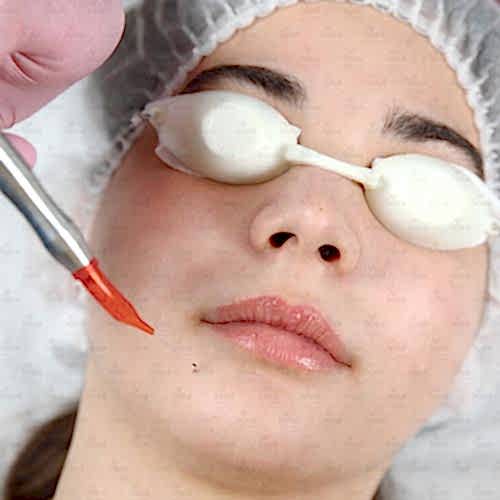 Лазерное лечение и удаление в косметологии: теория и практика Лазерное лечение и удаление в косметологии: теория и практика