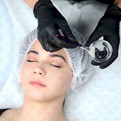 Химические пилинги в эстетической медицине. 36 баллов Химические пилинги в эстетической медицине. 36 баллов