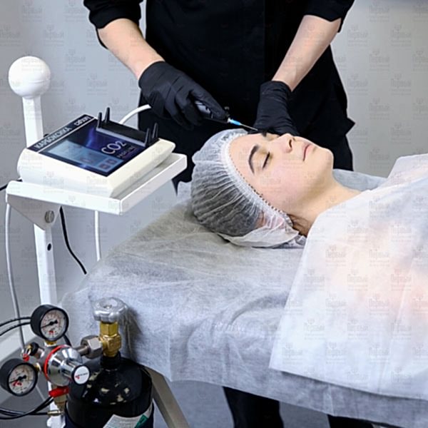 Инъекционная карбокситерапия в косметологии Инъекционная карбокситерапия в косметологии