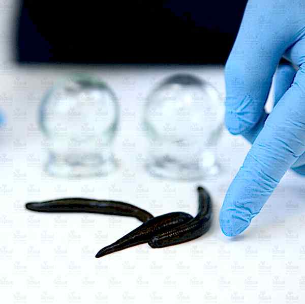 Основы гирудотерапии Основы гирудотерапии