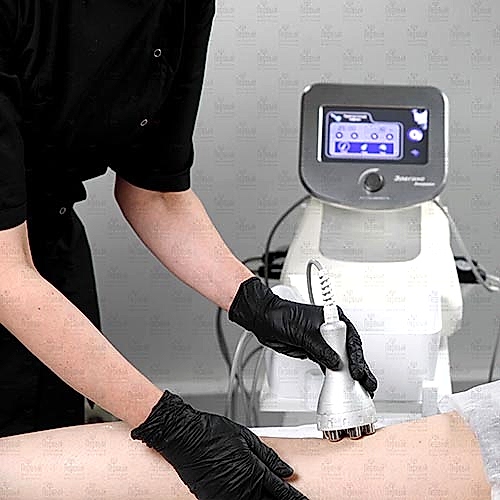 Ультразвуковая кавитация. Радиоволновый лифтинг Ультразвуковая кавитация. Радиоволновый лифтинг