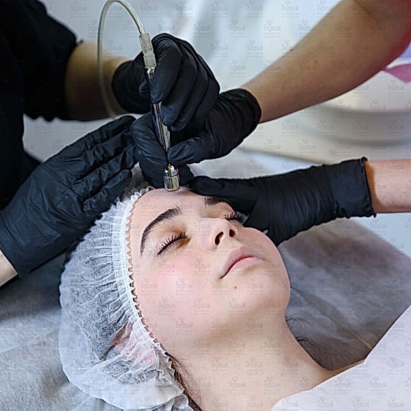 Микродермабразия в эстетической косметологии Микродермабразия в эстетической косметологии