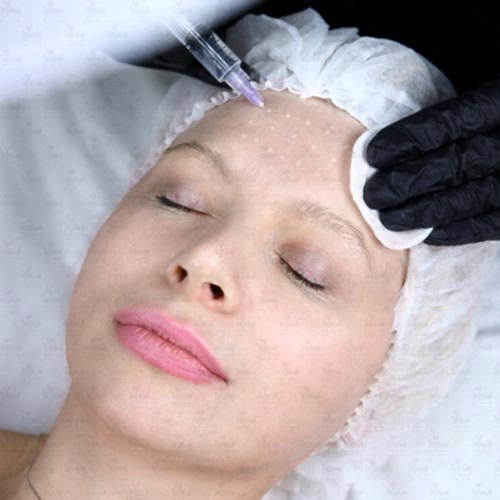 Основы и техники мезотерапии Основы и техники мезотерапии