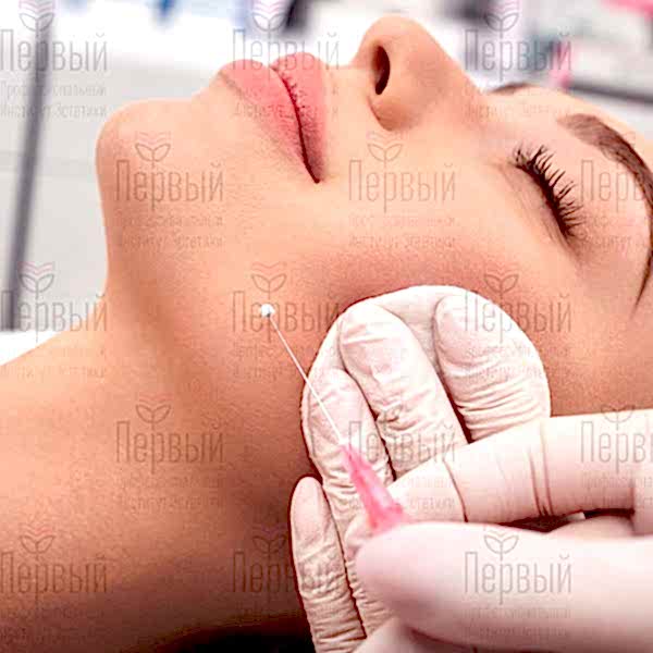 Нитевой лифтинг лица - дистанционное обучение Нитевой лифтинг лица - дистанционное обучение