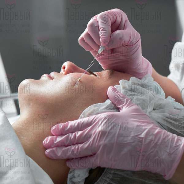 Нитевой лифтинг (общий курс) Нитевой лифтинг (общий курс)