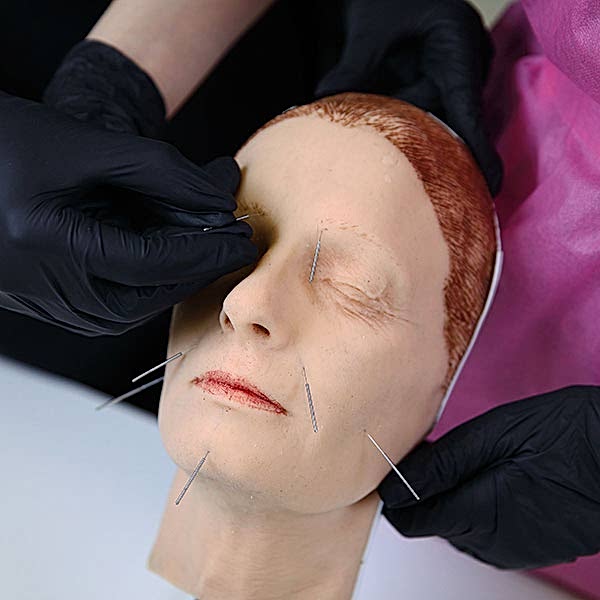 Лицевая акупунктура Лицевая акупунктура