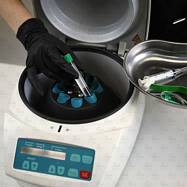 Плазмотерапия - процедура стимуляции ауторегенерации богатой тромбоцитами плазмы Плазмотерапия - процедура стимуляции ауторегенерации богатой тромбоцитами плазмы