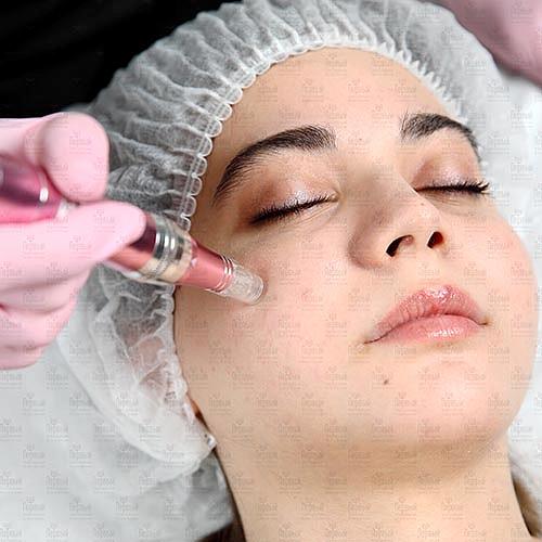 Фракционная мезотерапия - дистанционное обучение Фракционная мезотерапия - дистанционное обучение